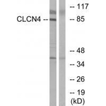 CLCN4 Antibody in Western Blot (WB)