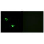 CHPF Polyclonal Antibody