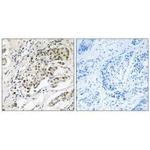 CDYL2 Polyclonal Antibody