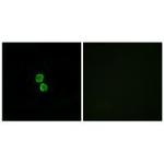 CMTM1 Antibody in Immunocytochemistry (ICC/IF)