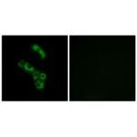 C1QB Polyclonal Antibody