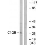 C1QB Antibody in Western Blot (WB)