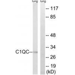 C1QC Antibody in Western Blot (WB)