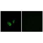 CNGA2 Polyclonal Antibody