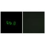 CSTL1 Polyclonal Antibody