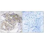 DHRS4 Polyclonal Antibody