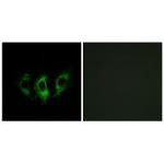 GFM2 Polyclonal Antibody