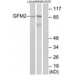 GFM2 Antibody in Western Blot (WB)