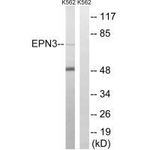 Epsin 3 Antibody in Western Blot (WB)