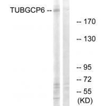 GCP6 Antibody in Western Blot (WB)