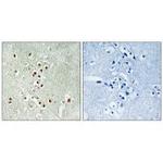 GADD45GIP1 Polyclonal Antibody