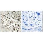 GIMAP5 Polyclonal Antibody