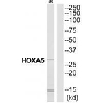 HOXA5 Antibody in Western Blot (WB)