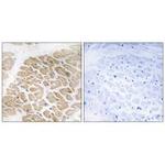 MIA Antibody in Immunohistochemistry (Paraffin) (IHC (P))