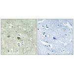 NDUFV3 Polyclonal Antibody