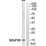 NDUFS5 Antibody in Western Blot (WB)