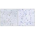 NPHP4 Antibody in Immunohistochemistry (Paraffin) (IHC (P))
