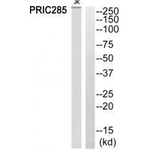 HELZ2 Polyclonal Antibody