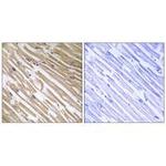 NDRG4 Polyclonal Antibody