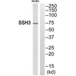 SSH3 Antibody in Western Blot (WB)