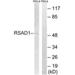 RSAD1 Antibody in Western Blot (WB)