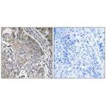 SPINK6 Polyclonal Antibody