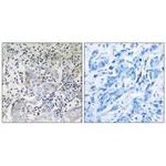 SESN1 Polyclonal Antibody