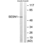 SESN1 Antibody in Western Blot (WB)