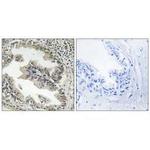 SH3GLB2 Polyclonal Antibody