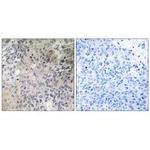 SHC3 Polyclonal Antibody