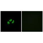 SCN7A Polyclonal Antibody