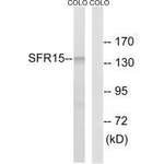 SFRS15 Polyclonal Antibody