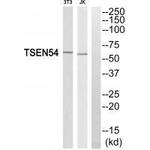 TSEN54 Antibody in Western Blot (WB)