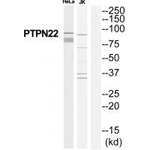 PTPN22 Polyclonal Antibody