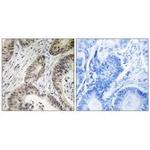 TUT1 Polyclonal Antibody