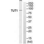 TUT1 Antibody in Western Blot (WB)