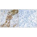 USP32 Polyclonal Antibody