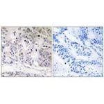 UBTD1 Polyclonal Antibody