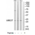 UBE2T Polyclonal Antibody