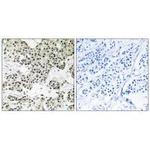 THOC5 Polyclonal Antibody