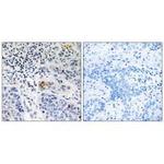 ZBTB40 Polyclonal Antibody