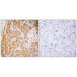 ZNF50 Polyclonal Antibody