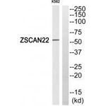ZNF50 Antibody in Western Blot (WB)
