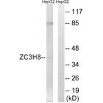 ZC3H8 Antibody in Western Blot (WB)