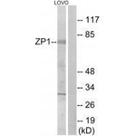 ZP1 Polyclonal Antibody