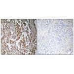 TBPL2 Polyclonal Antibody
