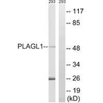 PLAGL1 Polyclonal Antibody