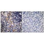 MCPH1 Polyclonal Antibody
