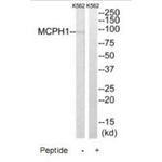 MCPH1 Antibody in Western Blot (WB)