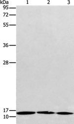 MPS1 Antibody in Western Blot (WB)